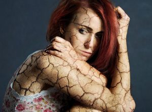 skóra recallhealing3