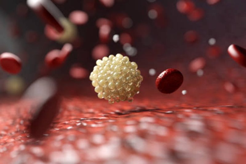 Lipoproteina a dozdrowia.pl