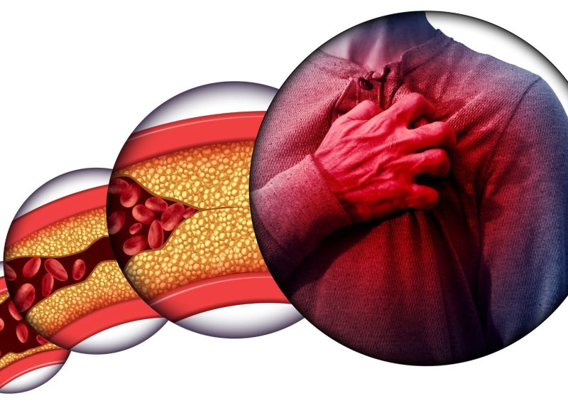 miażdżyca dozdrowia.pl