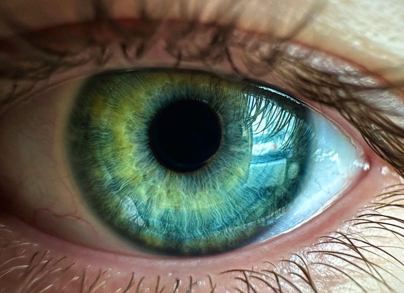 wrozk oczy badania wzroku